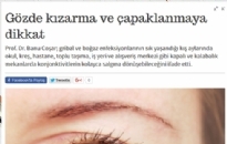 milliyet.com.tr</br>Gözde kızarma ve...</br> 11.11.2015