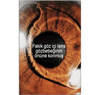 fakik goz ici lens goz ameliyatlari prof dr banu cosar la goz sagligi