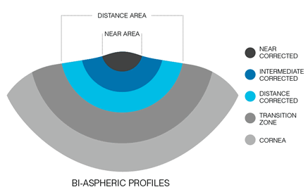 Presbi LASIK